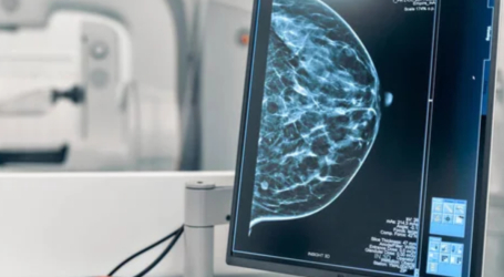 BECA DE PERFECCIONAMIENTO EN DIAGNÓSTICO MAMARIO E IMÁGENES GINECOLÓGICAS